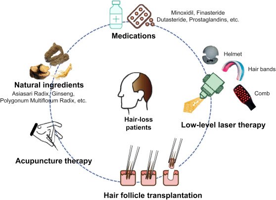 Aur Sunao - What This Means For Hair Loss: Hair Follicles Can Now Be Grown In Labs